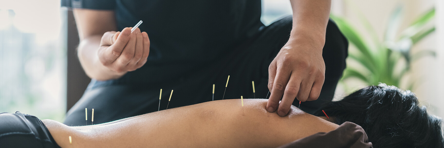 A person receiving acupuncture treatment with needles inserted into their body, lying on a massage table in a peaceful and serene environment.